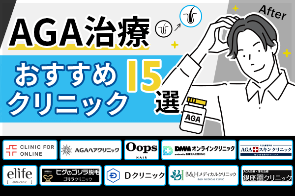 AGA治療おすすめのクリニック13選！料金が安い院と治療のデメリットを紹介【アンケートあり】