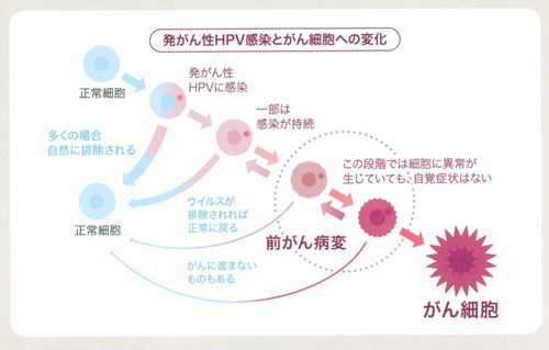 Hpvワクチンについて 横浜の婦人科 女医 ポートサイド女性総合クリニック ビバリータ